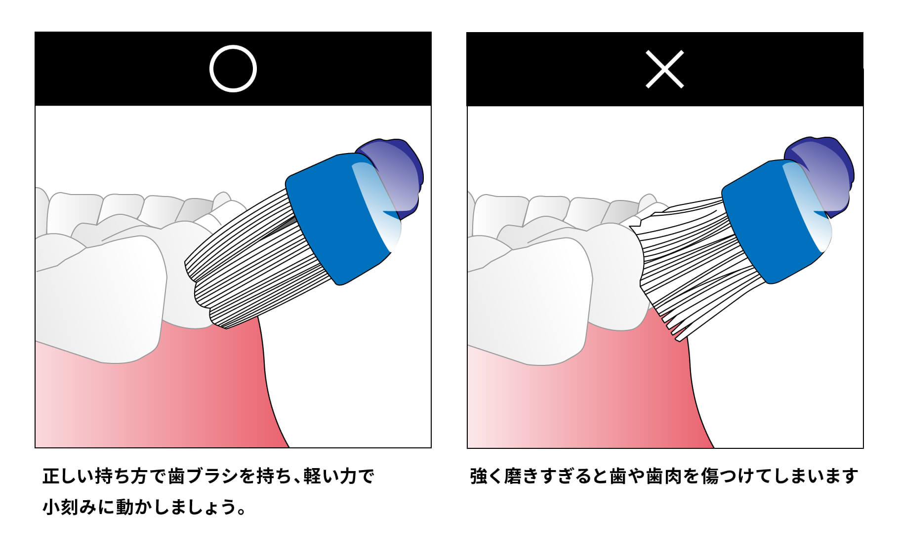 歯ブラシの使い方