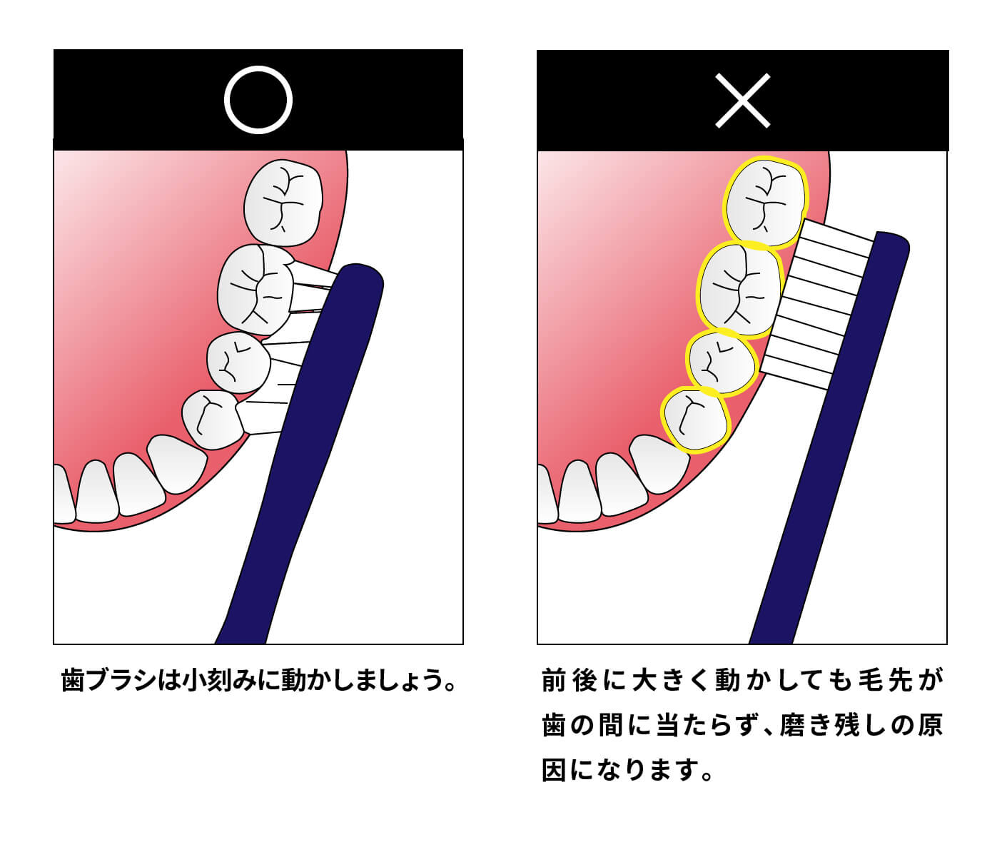 歯磨きの仕方