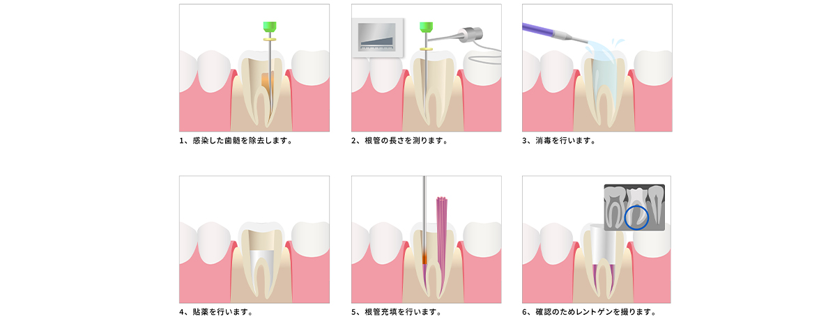 定期検診の内容